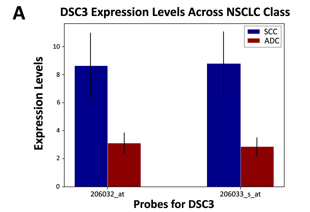 DSC3 expression in SCC and ADC