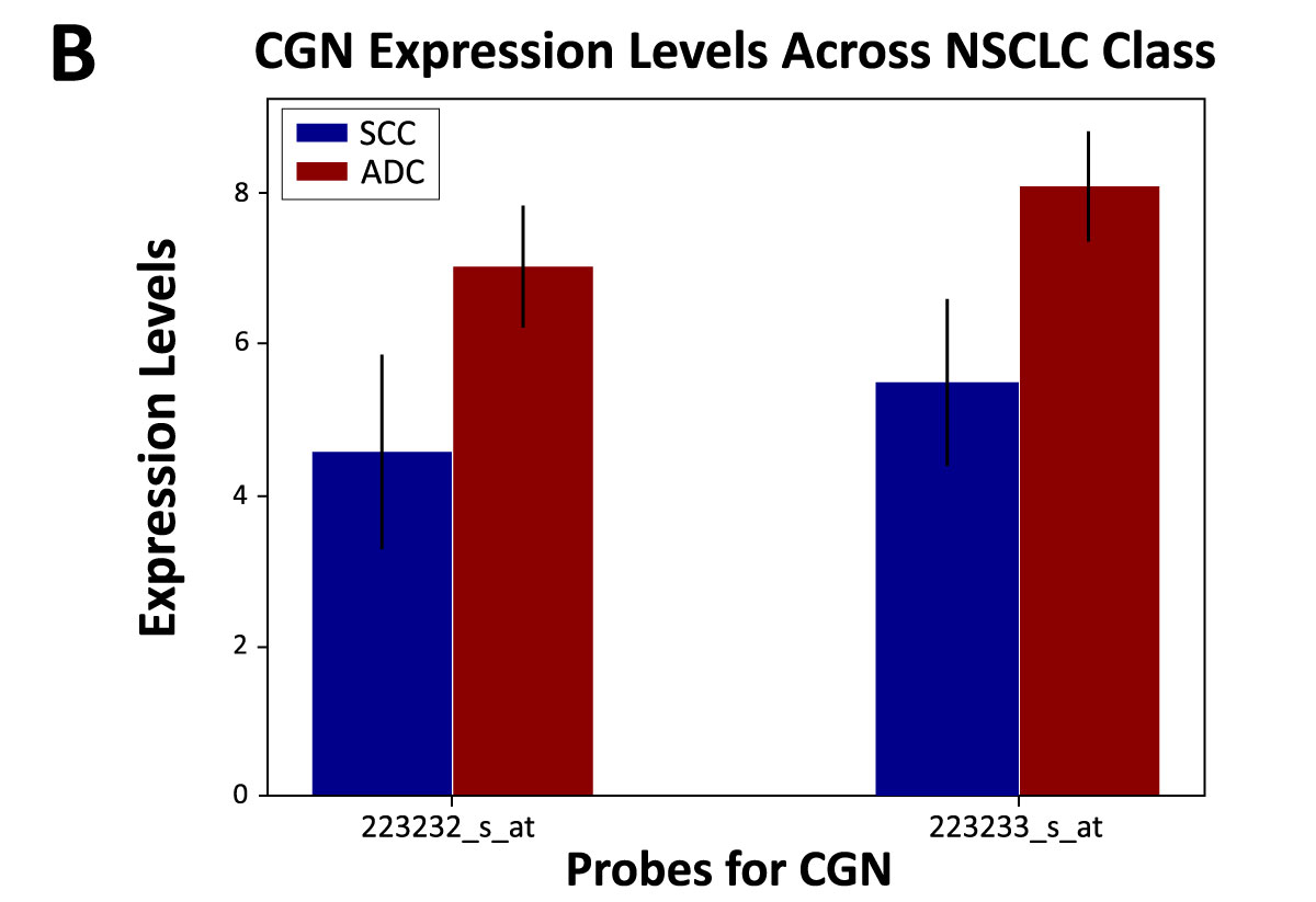 CGN expression in SCC and ADC